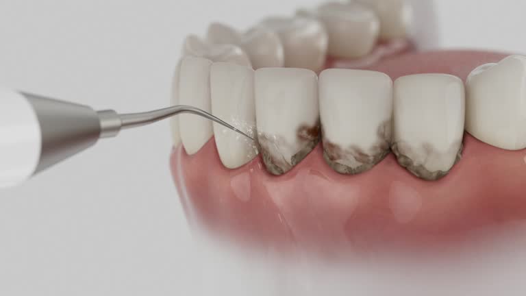 Trusted Emergency Dentist service in McCaysville, GA - Dentist Open Now